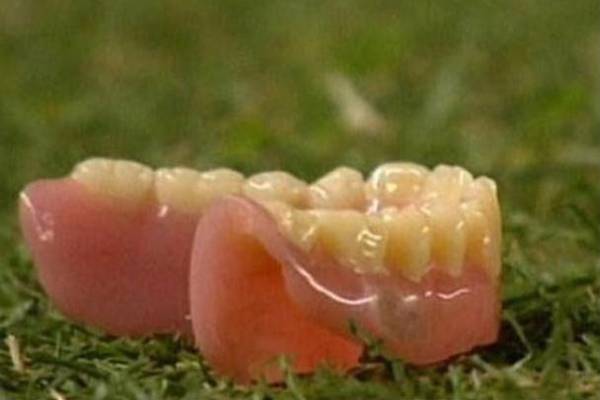 En Argentine, en 2013, c'est un dentier qui a été jeté sur la pelouse du match entre l'Argentinos Juniors et le Belgrano de Cordoba.